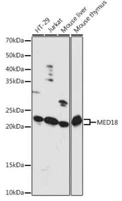 Western Blot: MED18 AntibodyAzide and BSA Free [NBP3-04941]